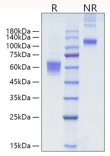 Recombinant Human NKG-2D/KLRK1/CD314 Protein