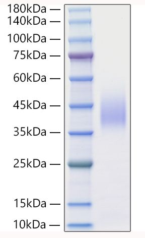 Recombinant Mouse IFN-beta Protein