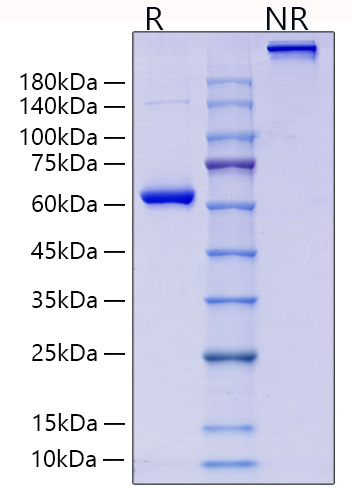 Recombinant Human Collagen II alpha 1/COL2A1 Protein