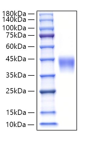 Recombinant Human Lutropin beta chain/LHB Protein