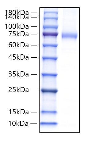 Recombinant Mouse Endoglin/ENG/CD105 Protein