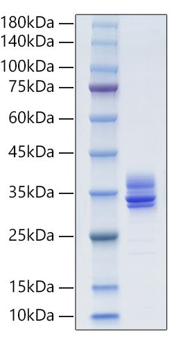 Recombinant Human MMP-7 Protein