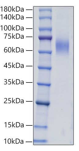 Recombinant Human Mucin-2 /MUC2 Protein