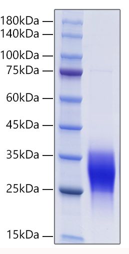 Recombinant Mouse Placenta growth factor/PLGF/PGF Protein