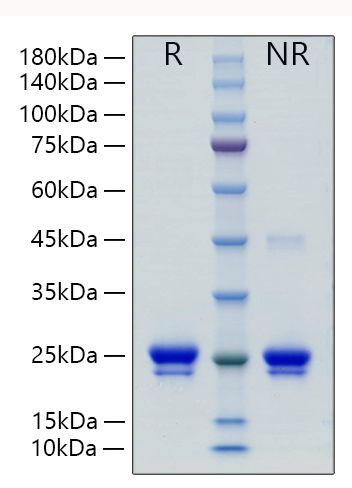 Recombinant Human Lipocalin-2/NGAL/LCN2 Protein