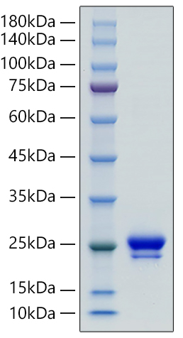 Recombinant Human Lipocalin-2/NGAL/LCN2 Protein