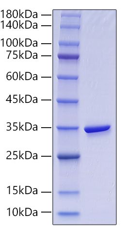 Recombinant Human Gamma-glutamyl hydrolase/GGH Protein