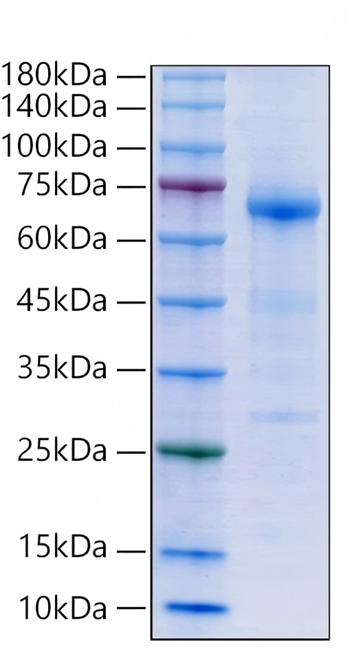 Recombinant Human Alkaline phosphatase/tissue-nonspecific isozyme/ALPL Protein