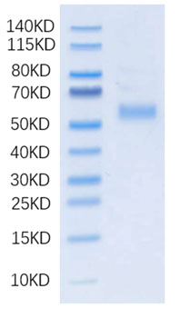 Recombinant Human DLL3 Protein