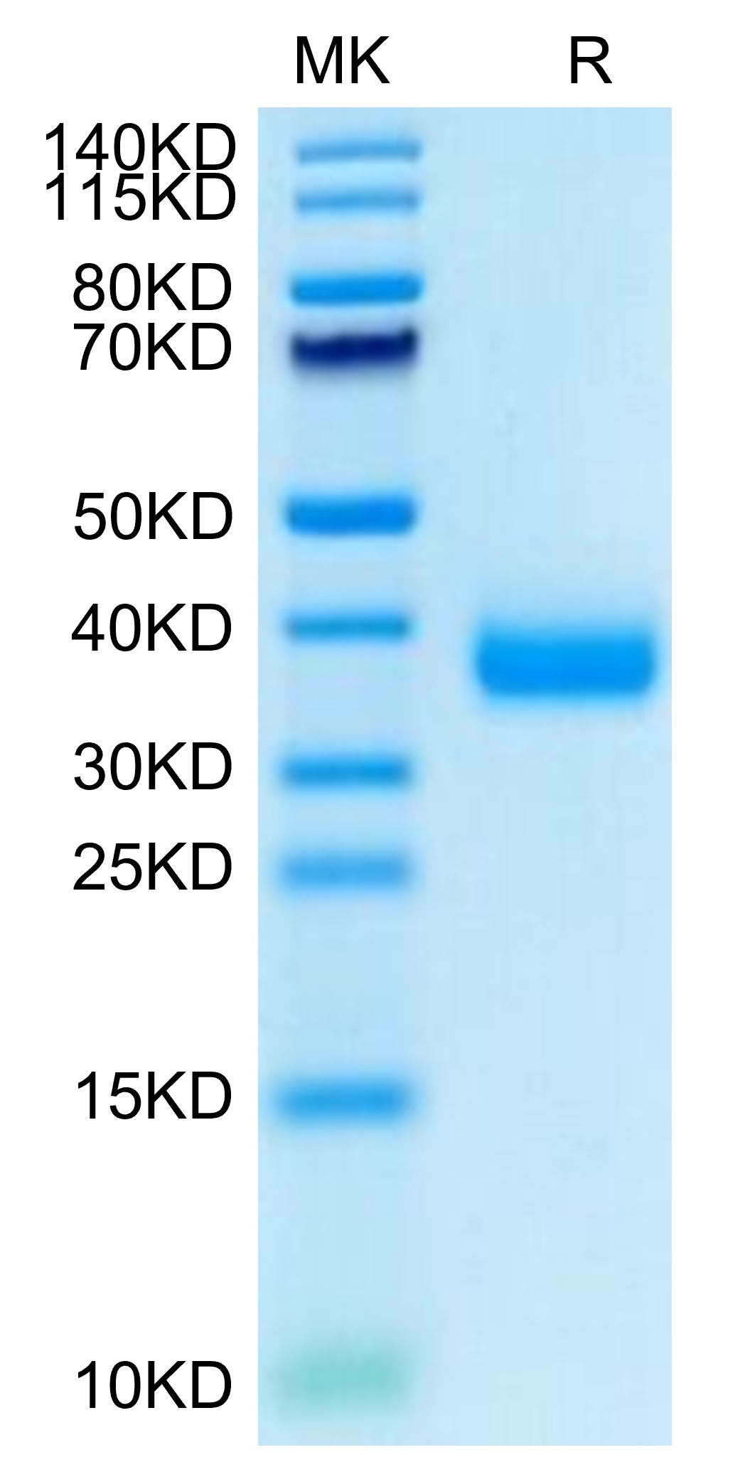 Recombinant SARS-CoV-2 Spike RBD(B.1.1.529/Omicron)  Protein