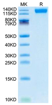 Recombinant SARS-CoV-2 Spike S1(B.1.1.529/Omicron) Protein