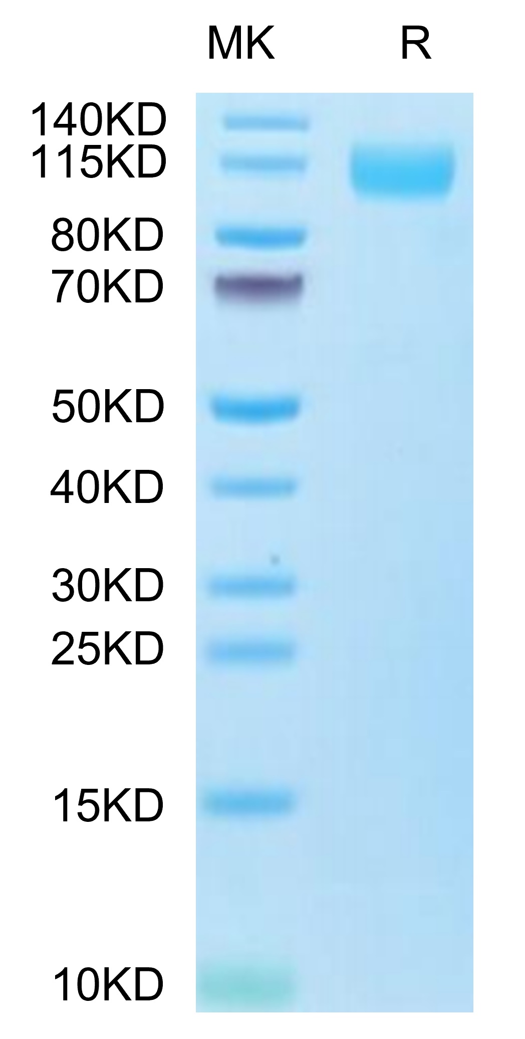 Biotinylated Recombinant SARS-CoV-2 Spike S1(B.1.1.529/Omicron) Protein