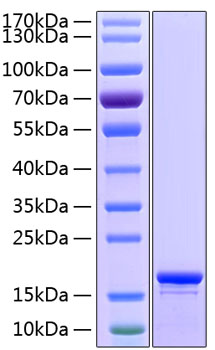 Recombinant Human Stathmin/STMN1 Protein