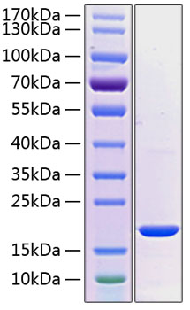 Recombinant Human PRL-2 Protein