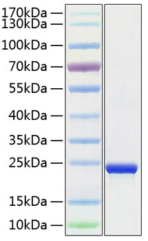 Recombinant Human TMPO Protein