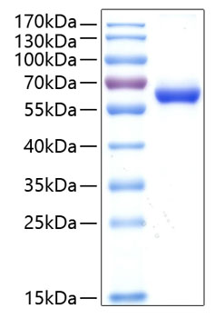 Recombinant Human DLL1 Protein