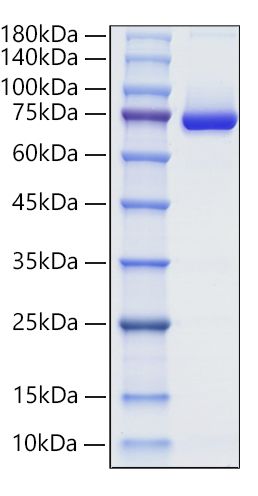 Recombinant Human Decorin/PG-S2/DCN Protein