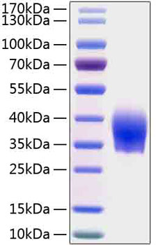 Recombinant Human SLAMF6/NTB-A/CD352 Protein