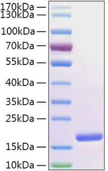 Recombinant Human FABP5/E-FABP Protein