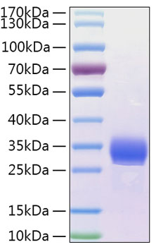 Recombinant Human Angiopoietin-like 4/ANGPTL4(166-406) Protein