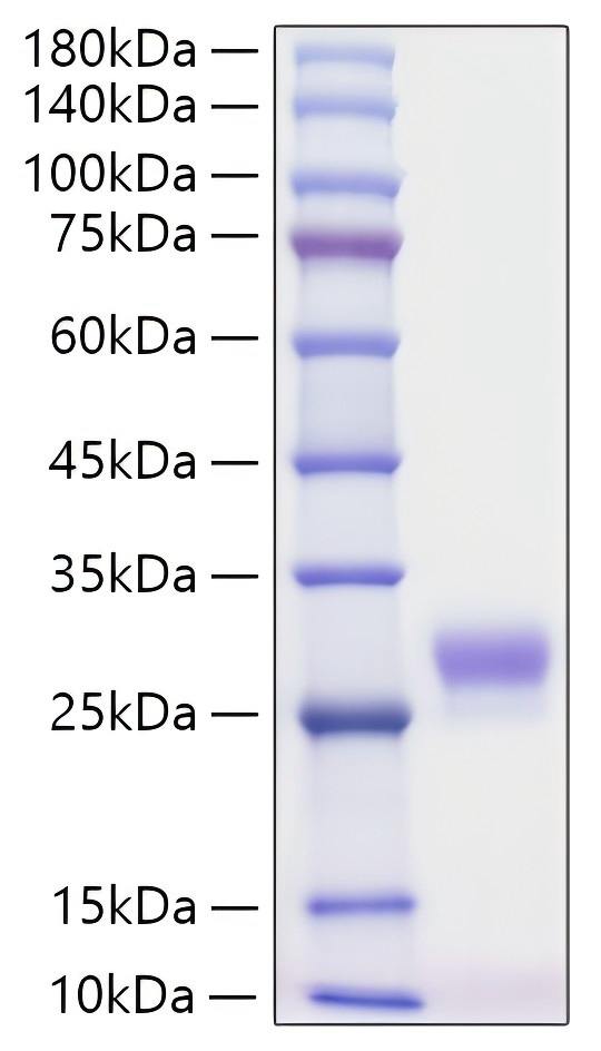 Recombinant Human IGF2BP2 Protein