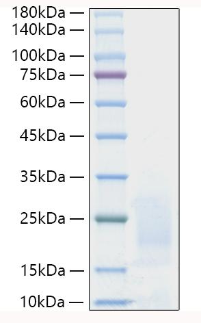 Recombinant Human Prostate stem cell antigen/PSCA Protein