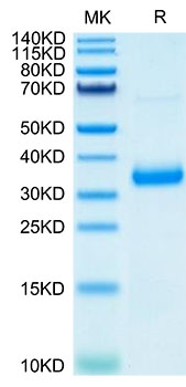 Recombinant SARS-COV-2 Spike RBD (N501Y,K417N,E484K) Protein