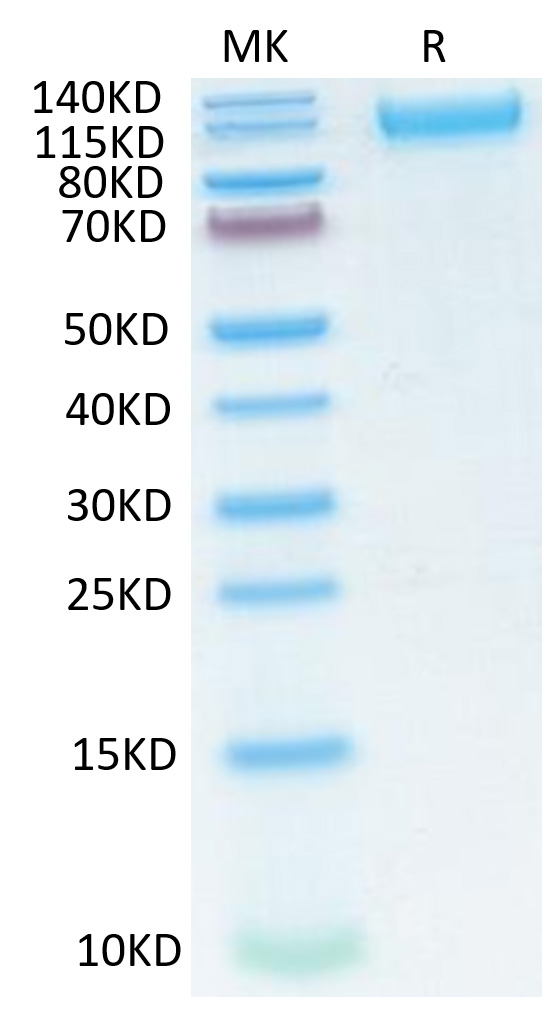 Recombinant SARS-COV-2 Spike S1 (N501Y,K417N,E484K) Protein