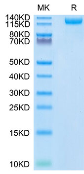 Recombinant SARS-COV-2 Spike S1 (N501Y) Protein