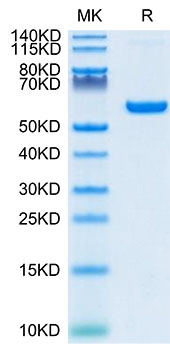 Recombinant SARS-COV-2 Spike RBD  Protein