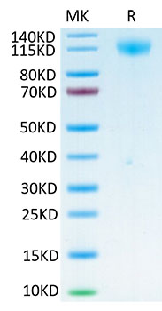 Biotinylated Recombinant SARS-COV-2 Spike S1 Protein