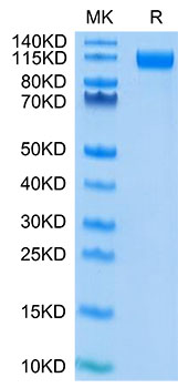 Recombinant SARS-COV-2 Spike S1(D614G) Protein