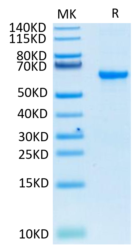 Recombinant SARS-COV-2 Spike RBD  Protein