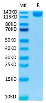 Recombinant SARS-COV-2 Spike S1 Protein