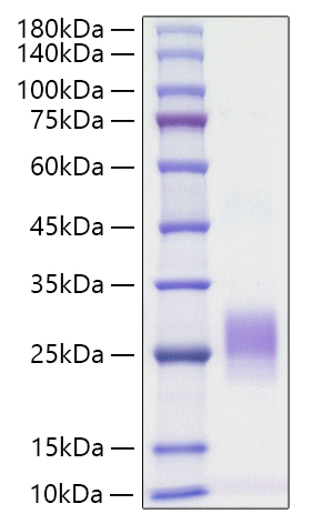 Recombinant Human TNFSF6/FAS ligand/CD178 Protein