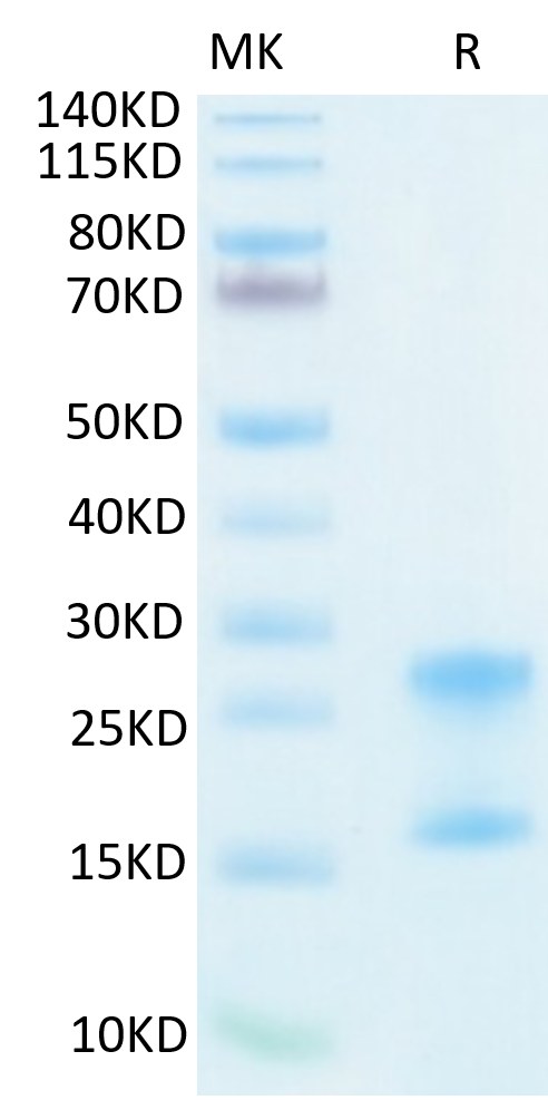 Recombinant Human IL-17A&IL-17F Protein