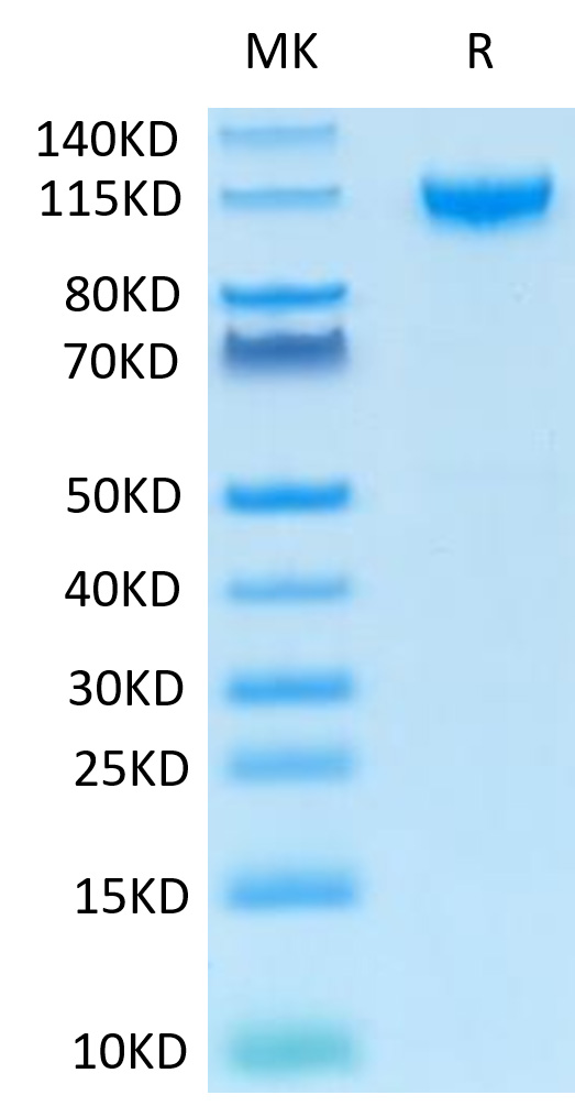 Recombinant Human IL-27RA/TCCR Protein