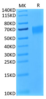 Biotinylated Recombinant Human IL-17RA/CD217 Protein