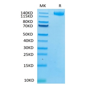 Recombinant Human Leukemia inhibitory factor receptor/LIF-R/CD118 Protein