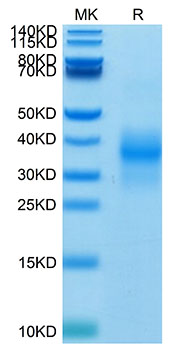 Biotinylated Recombinant Human NKG-2D/KLRK1/CD314 Protein