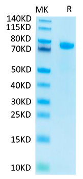 Recombinant Human Notch 1 Protein