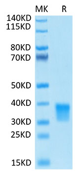 Biotinylated Recombinant Human Oncostatin-M/OSM Protein