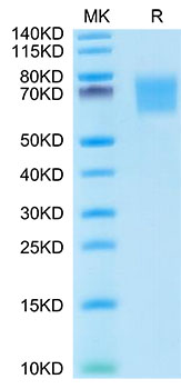 Recombinant Human FGFR-2 alpha (IIIb)/KGFR/CD332 Protein