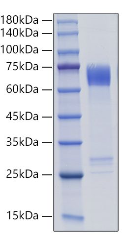 Recombinant Human MMP-8 Protein