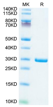 Recombinant SARS-COV-2 NSP7&NSP8 Protein