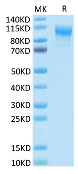 Recombinant Human IL-31RA Protein