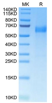 Recombinant Human B7-H7/HHLA2 Protein