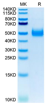 Recombinant Human IL-17RB Protein