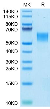 Recombinant Human ENPP-3(558-875) Protein