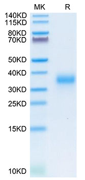 Recombinant Human DHLAG/CD74 Protein